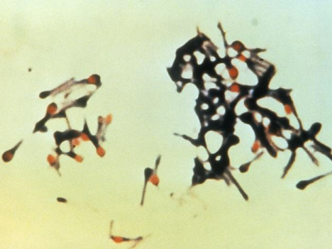 顕微鏡で見た破傷風菌（写真：CDC＝アメリカ疾病予防管理センター）